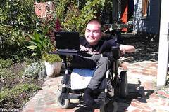 他将接受头颅移植手术