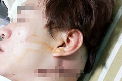 男子邀约18岁人妻 被女子丈夫怒砍