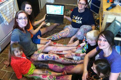 美骨癌女子截肢前为腿举办“欢送会”