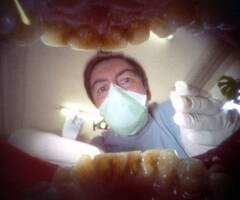 52岁男子口腔相机作品