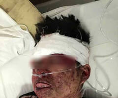 男子向包工头讨薪遭皮卡碾压