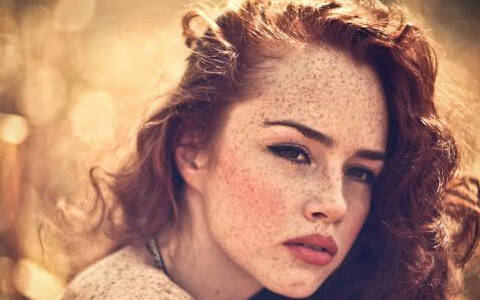 皮秒激光祛斑有什么弊端哪?