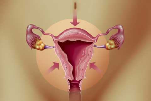女人怕宫颈癌,要定期做HPV检查与TCT检查,一