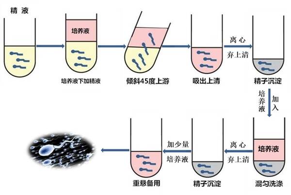 人均精子浓度_纸上精子高浓度