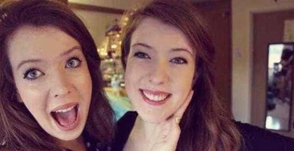 曾经被称命不久的双头姐妹,如今变成两个不可多得的