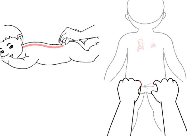 小儿捏脊可以经常捏吗图片