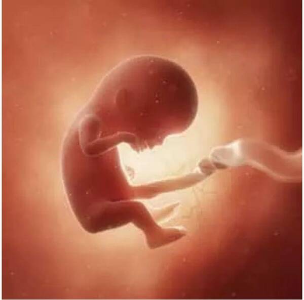 怀孕十二周胎儿高清图 植物妈妈有办法
