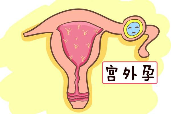 2,å­å¨å¼ä½å¦å¨ çæåµ