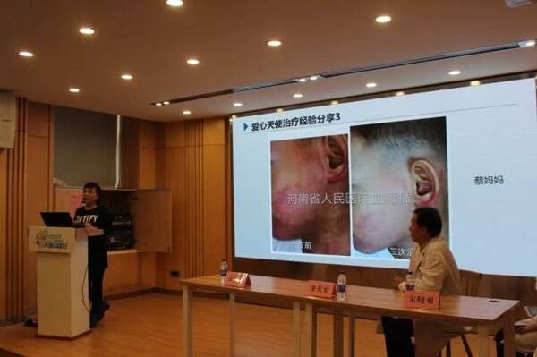 河南省人民医院血管瘤科举办鲜红斑痣患者见面