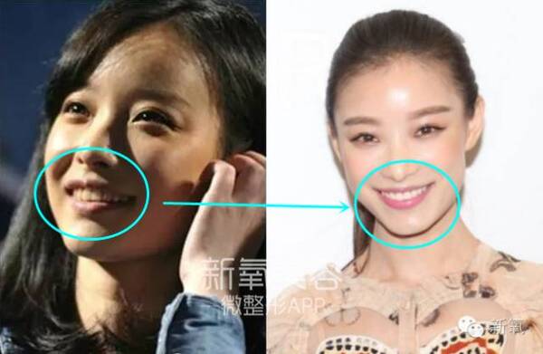 背薄了是不是脸就小了 C161BA629EC11672EEF7AA3CDAB9B6C6752EEFC1_size30_w640_h418.jpeg