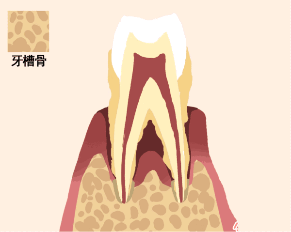牙齿究竟是如何脱落的?一张图片告诉你!