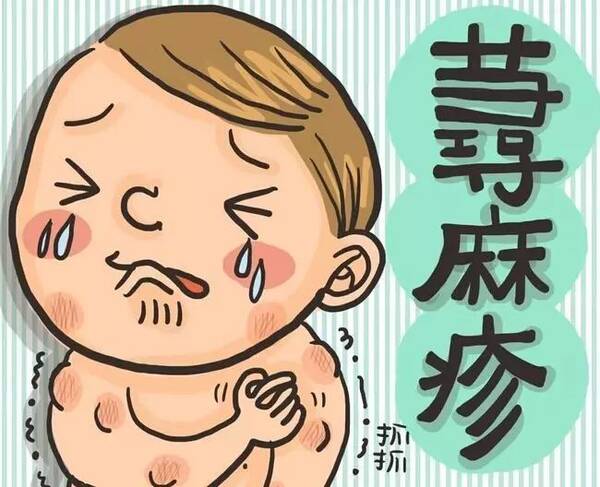 慢性荨麻疹怎么治