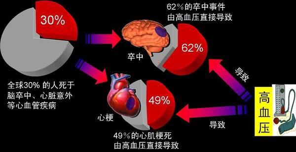高血压患者_高血压的人口比例