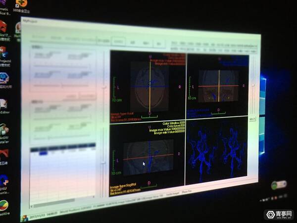 医生都对VR临床说不?他想把3D影像重建技术