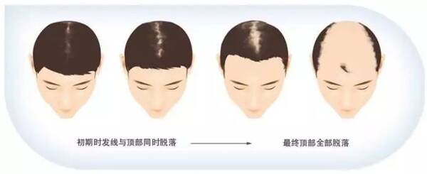 年轻时曾迷倒香港万千少女的他,如今70岁走路