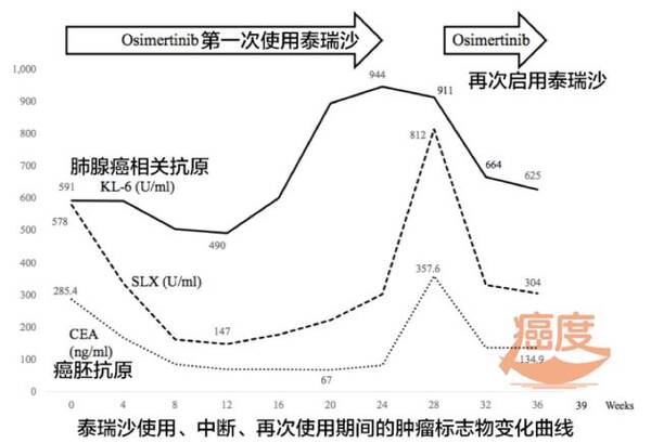 典型案例:肺癌患者靶向治疗出现严重不良反应