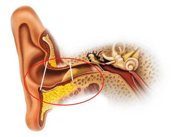 耳屎不同形状代表什么?耳屎堵在外耳道正常