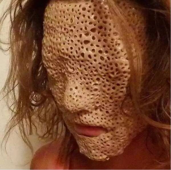 重口味密集恐惧症图片 超恶心密集恐惧症图片