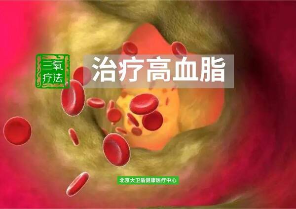 三氧自血疗法治疗高血脂症