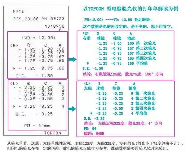 与你的眼睛对话,验光单是他给你的最长情告白