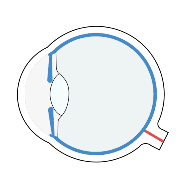 晶状体,玻璃体等结构)出现了异常,导致眼睛在调节放松的状态下,外界