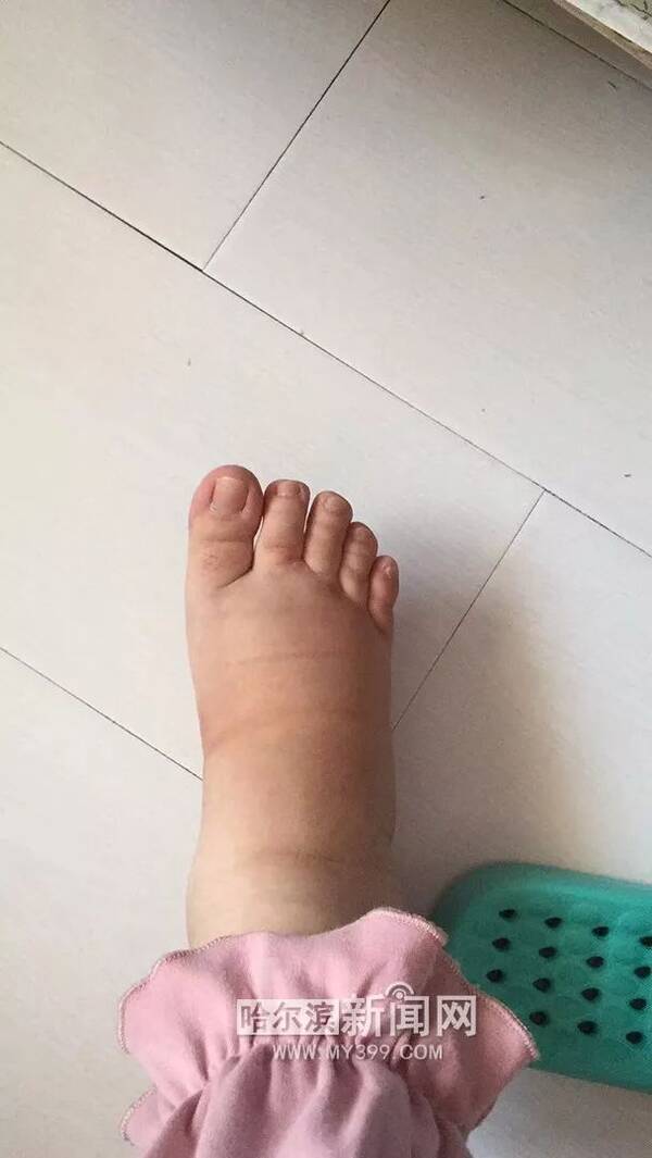 满月脸、水牛背、垂悬腹…|以为怀了个男孩才