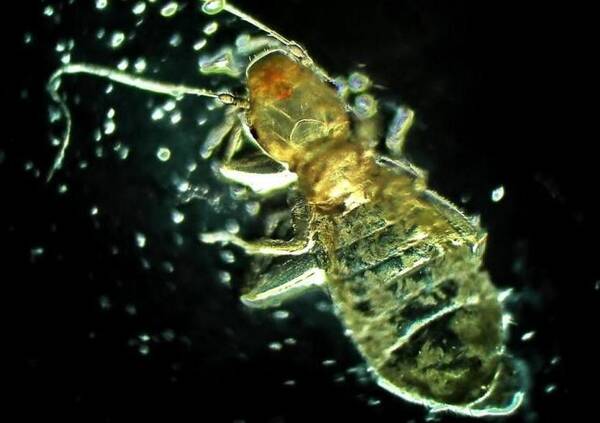 脸上螨虫相当于蛀虫,洗脸掌握3招,层层螨虫全