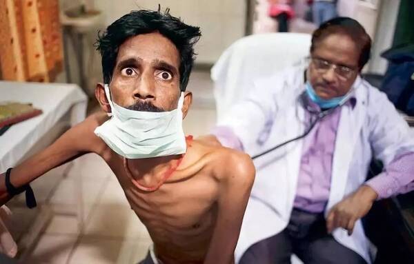 对穷人来说,印度的医疗水平只是看起来很美