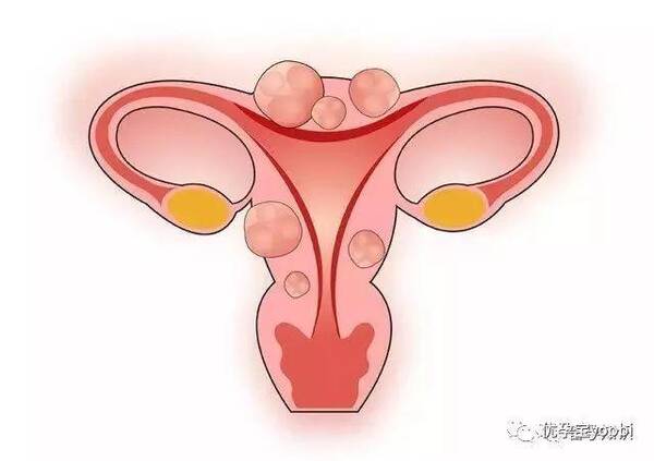 子宫内膜异位症到哪家大医院治得好