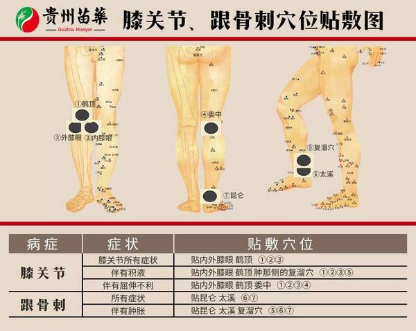 阿祖苗药，穴位用药治百病，穴位贴敷示意