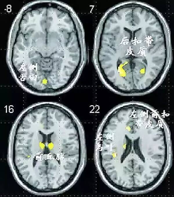 网瘾之戒:被父母忽略的小事,是他难以排解的