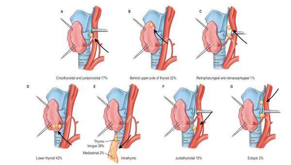 甲状旁腺这个戏精:4个旁腺一台戏,减退亢进发