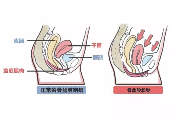 盆底肌、骨盆和腹直肌产后必做?它们的区别在