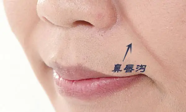 北京八大处整形马继光：鼻唇沟怎么改善好？丨北京八大处鼻整形医生