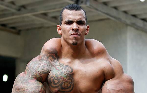 25岁健美运动员往手臂中注射油和酒精 险致截