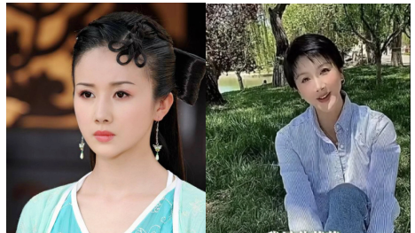 女星曾因变丑引群嘲，如今自曝：是患这种病！专偷颜值还伤身