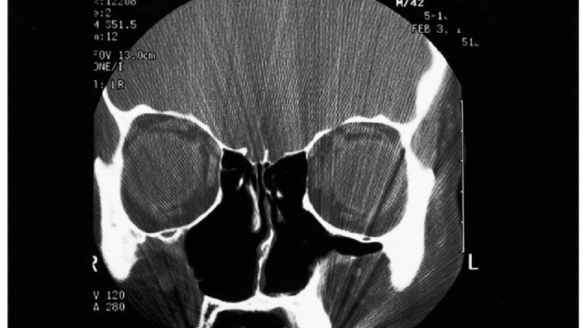 做完手术痛到想自杀，医生却说「你没病」