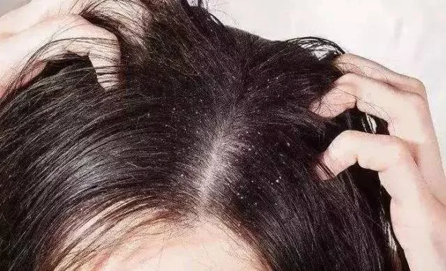 洗发水哪个牌子好？去屑止痒控油还得是康王！