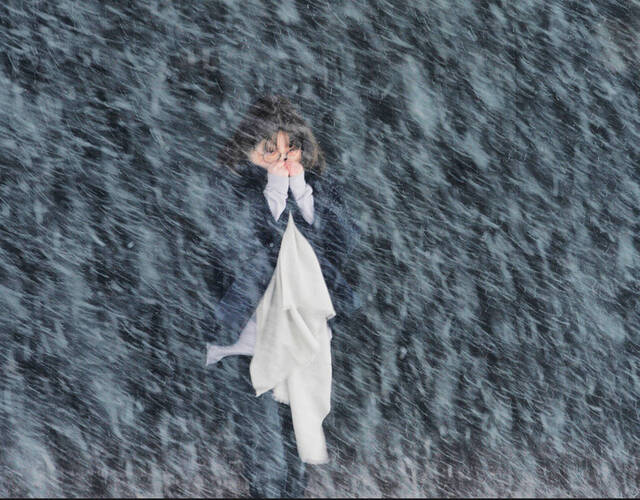 身缝一万针:毁容女孩的坚强人生