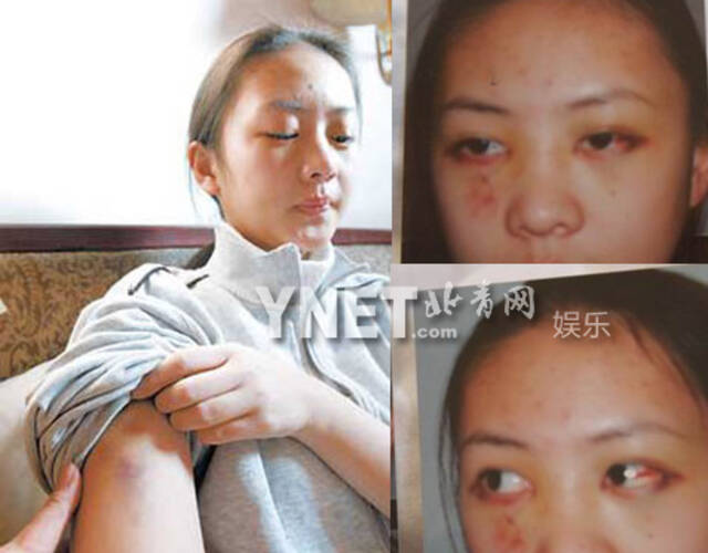 张国立之子张默殴打女友童谣震惊了娱乐圈,据悉,张默打人是因为怀疑