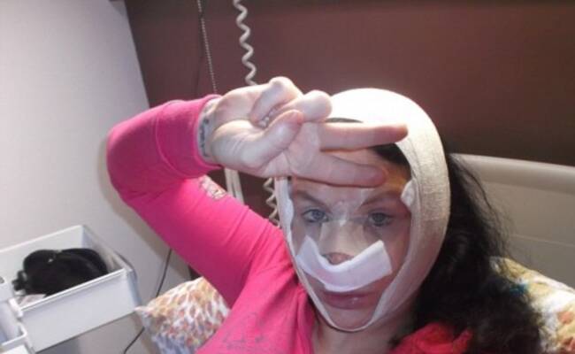 美国一女演员整容36次