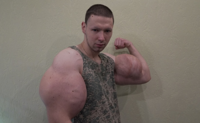 现实版“大力水手” 胳膊粗达61厘米