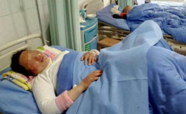 长沙餐厅卡式炉爆炸，一桌9人全被烧伤