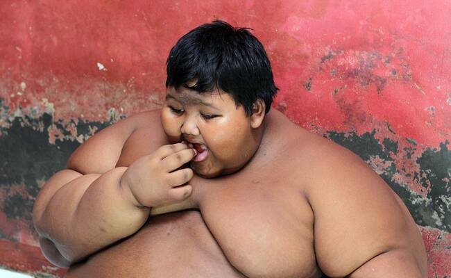 世界最胖的男孩