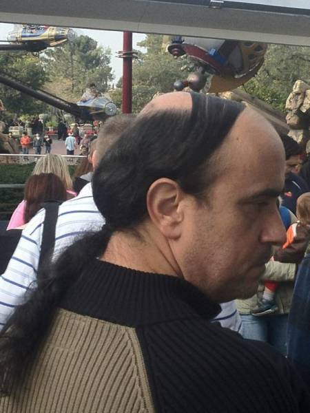 囧图161219:超级赛亚人的能力都没法治秃头