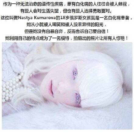 异次元观光150623:直面白化病 将自身的美表现得淋漓尽致