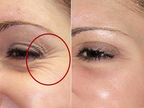 蜂蜜中放点蔬菜汁坚持敷脸十天 脸部皱纹全消