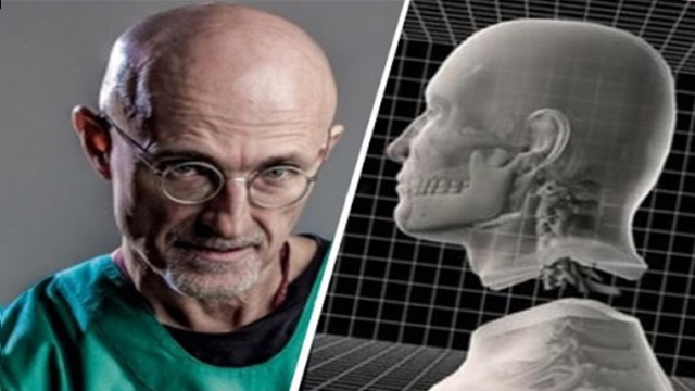 全球首例人类换头手术将在今年内进行惊悚程度如恐怖电影