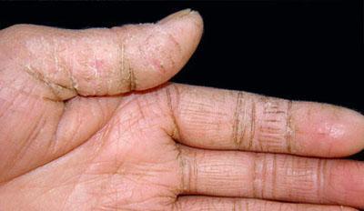 教你几个小妙招,两三天就手娇嫩如水