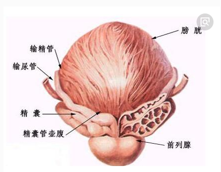 前列腺癌这么吃让病人康复康复最快?